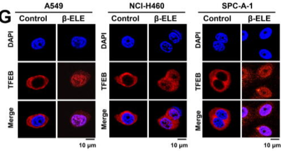 Live Cell and Super Resolution Imaging