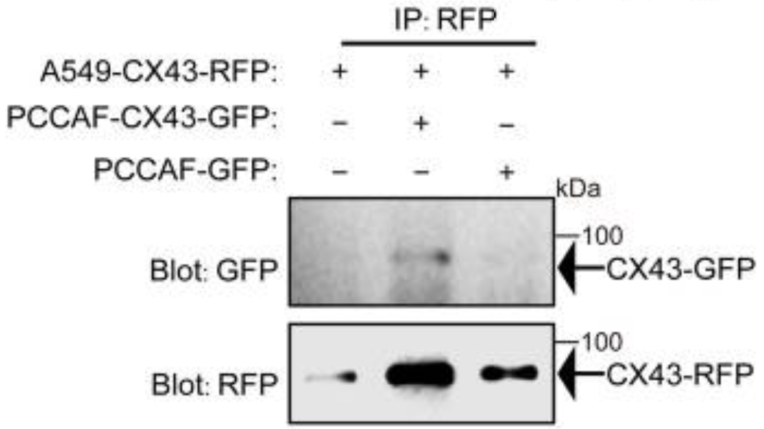 Protein Complex Preservation for Co IP and Pull Down